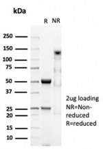 SDS-PAGE analysis of purified, BSA-free CD74 antibody (clone CLIP/7023R) as confirmation of integrity and purity.