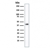 Western blot testing of human kidney tissue lysate using AMACR antibody. Predicted molecular weight ~43 kDa.