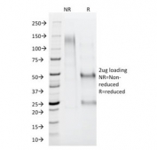 SDS-PAGE analysis of purified, BSA-free AMACR antibody as confirmation of integrity and purity.