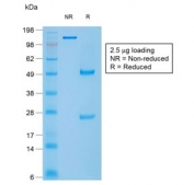 SDS-PAGE analysis of purified, BSA-free recombinant Caldesmon antibody (clone rCALD1/820) as confirmation of integrity and purity.