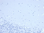 Negative control: IHC staining of FFPE human brain tissue with DNA nucleotidylexotransferase antibody (clone DNTT/4506R) at 2ug/ml in PBS for 30min RT. HIER: boil tissue sections in pH 9 10mM Tris with 1mM EDTA for 20 min and allow to cool before testing.