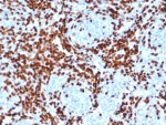 IHC staining of FFPE human thymus tissue with DNA nucleotidylexotransferase antibody (clone DNTT/4506R). HIER: boil tissue sections in pH 9 10mM Tris with 1mM EDTA for 20 min and allow to cool before testing.