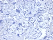 Negative control: IHC staining of FFPE human placental tissue with recombinant Androgen Receptor antibody (clone clone DHTR/4445R). HIER: boil tissue sections in pH 9 10mM Tris with 1mM EDTA for 20 min and allow to cool before testing.