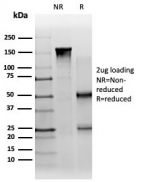 SDS-PAGE analysis of purified, BSA-free PBX1 antibody (PCRP-PBX1-3C8) as confirmation of integrity and purity.
