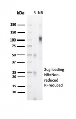SDS-PAGE analysis of purified, BSA-free recombinant Progesterone Receptor antibody (clone PGR/6854R) as confirmation of integrity and purity.