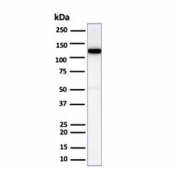 Western blot analysis of human heart tissue lysate using recombinant N-Cadherin antibody (clone CDH2/6857R). Predicted molecular weight ~100 kDa (unmodified), 125-140 kDa (modified).