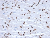 IHC staining of intercalated discs in FFPE human heart tissue with recombinant N-Cadherin antibody (clone CDH2/6857R). HIER: boil tissue sections in pH 9 10mM Tris with 1mM EDTA for 20 min and allow to cool before testing.