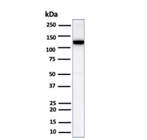 Western blot analysis of human heart tissue lysate using recombinant N-Cadherin antibody (clone CDH2/6857R). Predicted molecular weight ~100 kDa (unmodified), 125-140 kDa (modified).