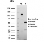 SDS-PAGE analysis of purified, BSA-free CEA antibody (clone C66/1292) as confirmation of integrity and purity.