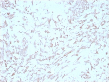 IHC staining of FFPE human liver tissue with Kindlin 2 antibody (clone 3A3). HIER: boil tissue sections in pH 9 10mM Tris with 1mM EDTA for 20 min and allow to cool before testing.~