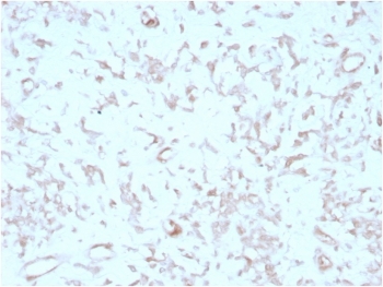 IHC staining of FFPE human liver tissue with Kindlin 2