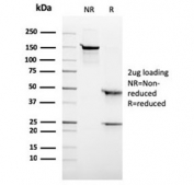 SDS-PAGE analysis of purified, BSA-free recombinant Anaplastic Lymphoma Kinase antibody (rALK1/1504) as confirmation of integrity and purity.
