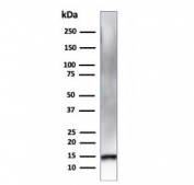 Western blot testing of human heart tissue lysate using RETN antibody (clone RETN/4326). Predicted molecular weight ~11 kDa.