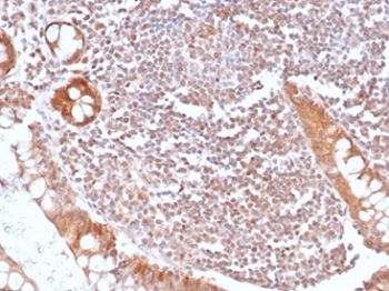 IHC staining of FFPE human small intestine with recombinant SMAD4 antibody (clone SMAD4/6309R). HIER: boil tissue sections in pH 9 10mM Tris with 1mM EDTA for 20 min and allow to cool before testing.~