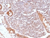 IHC staining of FFPE human small intestine with recombinant SMAD4 antibody (clone SMAD4/6309R). HIER: boil tissue sections in pH 9 10mM Tris with 1mM EDTA for 20 min and allow to cool before testing.