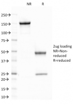 SDS-PAGE analysis of purified, BSA-free CELA3B antibody (clone CELA3B/1758) as confirmation of integrity and purity.