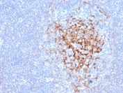 IHC staining of FFPE human tonsil tissue with CD35 antibody (clone CR1/6383) at 2ug/ml. HIER: boil tissue sections in pH 9 10mM Tris with 1mM EDTA for 20 min and allow to cool before testing.