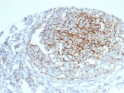 IHC staining of FFPE human tonsil tissue with CD35 antibody (clone CR1/6383) at 2ug/ml. HIER: boil tissue sections in pH 9 10mM Tris with 1mM EDTA for 20 min and allow to cool before testing.