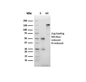 SDS-PAGE analysis of purified, BSA-free recombinant Albumin antibody (clone ALB/6413R) as confirmation of integrity and purity.