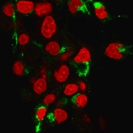 Immunofluorescent staining of human HeP-G2 cells labeled with Albumin antibody (green, clone ALB/6413R) and RedDot (red).
