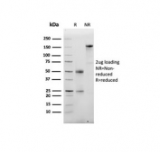 SDS-PAGE analysis of purified, BSA-free recombinant Albumin antibody (clone ALB/6413R) as confirmation of integrity and purity.