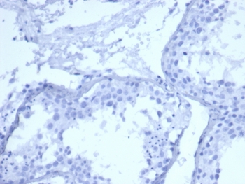 Negative control: IHC staining of FFPE human testis tissue with recombinant Cytokeratin 5 antibody (clone rKRT5/6398) at 2ug/ml in PBS for 30min RT. HIER: boil tissue sections in pH 9 10mM Tris with 1mM EDTA for 20 min and allow to cool before testing.