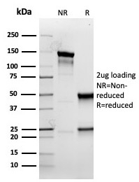 SDS-PAGE analysis of purified, BSA-free recombinant Cytokeratin 5 antibody (clone rKRT5/6398) as confirmation of integrity and purity.