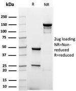 SDS-PAGE analysis of purified, BSA-free Albumin antibody (clone rALB/6414) as confirmation of integrity and purity.