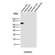 Albumin Antibody Liver Tissue WB. Western blot analysis of human, mouse, rat, hamster, and guinea pig liver tissue lysates using Albumin antibody detects a strong band at approximately 65-70 kDa in human liver, consistent with the predicted molecular weight of Albumin (ALB), with minimal signal observed in other species under these conditions; detection was performed with clone rALB/6414.
