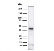 Western blot testing of human Y79 cell lysate using Glutamine Synthetase antibody (clone GLUL/6600). Predicted molecular weight ~42 kDa.