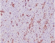 IHC staining of FFPE human pancreatic tissue with SOX9 antibody (clone SOX9/2387) at 2ug/ml. HIER: boil tissue sections in pH 9 10mM Tris with 1mM EDTA for 20 min and allow to cool before testing.