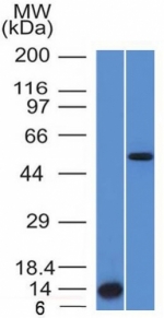 Western blot analysis (A) recombinant protein and (B) human HepG2 cell lysate using ALK antibody (clone ALK/1503).