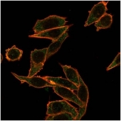Immunofluorescent staining of PFA-fixed human HeLa cells using FOXB1 antibody (green, clone PCRP-FOXB1-1B7) and phalloidin (red).