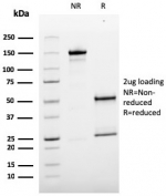 SDS-PAGE analysis of purified, BSA-free MCAM antibody (clone MCAM/3179) as confirmation of integrity and purity.