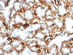 IHC staining of FFPE human kidney tissue with recombinant Wilms Tumor 1 antibody (clone WT1/3477R). HIER: boil tissue sections in pH 9 10mM Tris with 1mM EDTA for 20 min and allow to cool before testing.