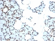 IHC staining of FFPE human salivary gland with XRCC5/Ku80 antibody (clone XRCC5/7315). HIER: boil tissue sections in pH 9 10mM Tris with 1mM EDTA for 20 min and allow to cool before testing.
