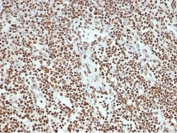 IHC staining of FFPE human lymph node tissue with XRCC5/Ku80 antibody (clone XRCC5/7315). HIER: boil tissue sections in pH 9 10mM Tris with 1mM EDTA for 20 min and allow to cool before testing.