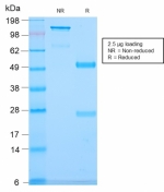 SDS-PAGE analysis of purified, BSA-free CD79b antibody (clone IGB/2940R) as confirmation of integrity and purity.