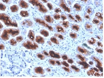 IHC staining of FFPE human stomach tissue with MUC1 antibody (clone Mc5). Negative control inset: PBS instead of primary antibody to control for secondary binding. HIER: boil tissue sections in pH 9 10mM Tris with 1mM EDTA for 20 min and allow to cool before testing.~