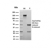 SDS-PAGE analysis of purified, BSA-free recombinant MyoD1 antibody (clone rMYOD1/6911) as confirmation of integrity and purity.