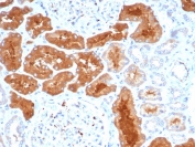 IHC staining of FFPE human kidney tissue with Daxx antibody (clone PCRP-DAXX-8C2). HIER: boil tissue sections in pH 9 10mM Tris with 1mM EDTA for 20 min and allow to cool before testing.
