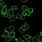 Immunofluorescent staining of PFA-fixed human HeLa cells using Daxx antibody (green, clone PCRP-DAXX-8C2).
