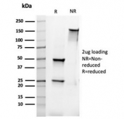 SDS-PAGE analysis of purified, BSA-free recombinant Bcl-2 antibody (rBCL2/6418) as confirmation of integrity and purity.