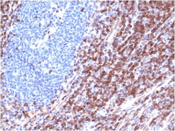 IHC staining of FFPE human tonsil tissue with recombinant Bcl-2 antibody (clone rBCL2/6418). HIER: boil tissue sections in pH 9 10mM Tris with 1mM EDTA for 20 min and allow to cool before testing.~