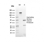 SDS-PAGE analysis of purified, BSA-free recombinant ACTH antibody (clone rCLIP/1407) as confirmation of integrity and purity.