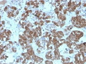 IHC staining of FFPE human pituitary tissue with recombinant ACTH antibody (clone rCLIP/1407). HIER: boil tissue sections in pH 9 10mM Tris with 1mM EDTA for 20 min and allow to cool before testing.