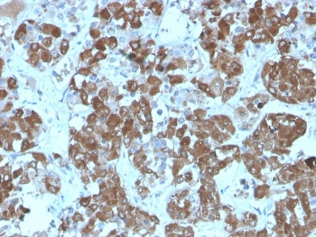 IHC staining of FFPE human pituitary tissue with recombinant ACTH antibody (clone rCLIP/1407). HIER: boil tissue sections in pH 9 10mM Tris with 1mM EDTA for 20 min and allow to cool before testing.