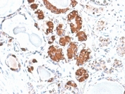 IHC staining of FFPE human pituitary with ACTH antibody (clone rCLIP/1407). HIER: boil tissue sections in pH 9 10mM Tris with 1mM EDTA for 20 min and allow to cool before testing.