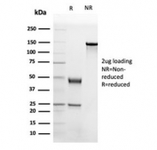 SDS-PAGE analysis of purified, BSA-free APOB antibody (clone APOB/4332) as confirmation of integrity and purity.