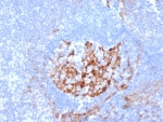 IHC staining of FFPE human tonsil tissue with CD35 antibody (clone CR1/6380) at 2ug/ml. HIER: boil tissue sections in pH 9 10mM Tris with 1mM EDTA for 20 min and allow to cool before testing.